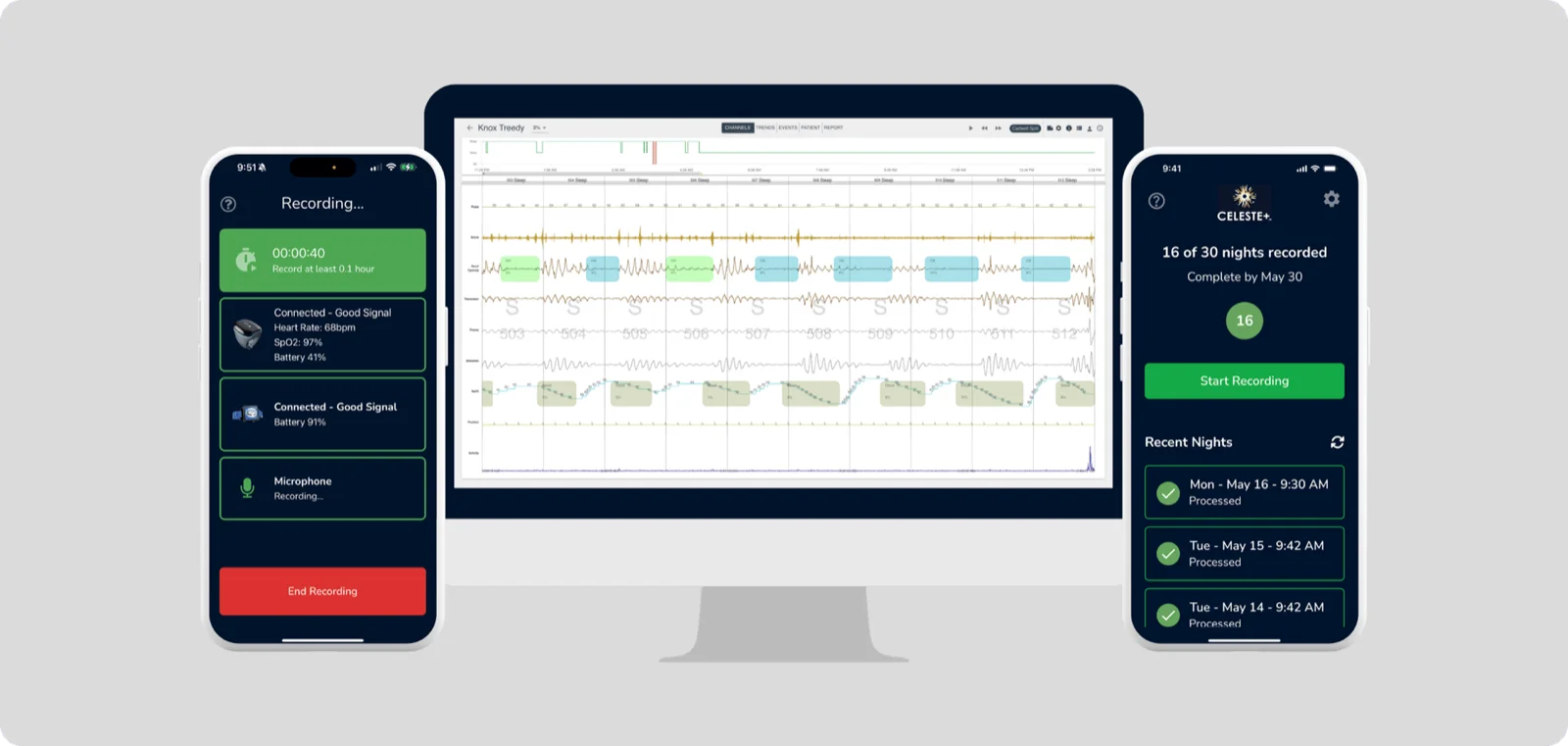 EnsoData sleep diagnostics app on phones and a desktop dashboard